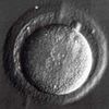 Astoria Couple Sues Hospital For Destroying Their Embryos